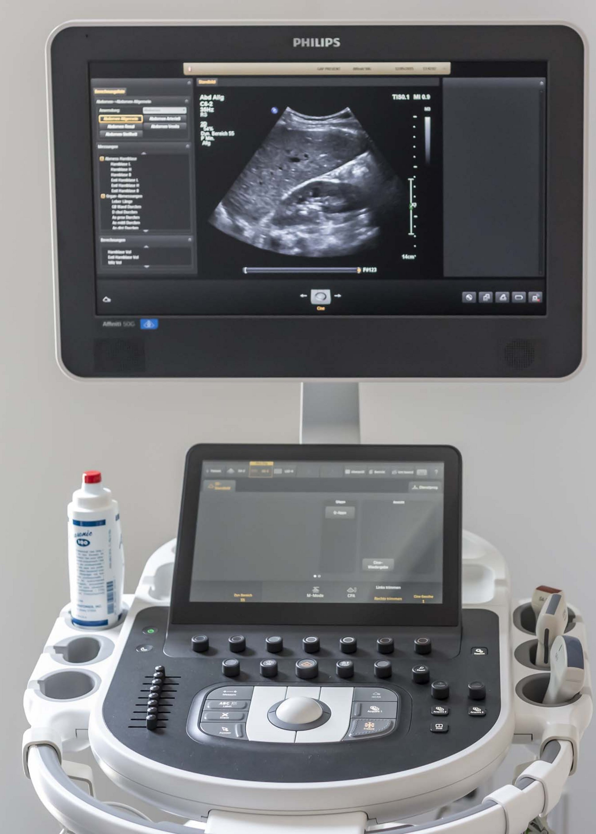 Untersuchung Untersuchung